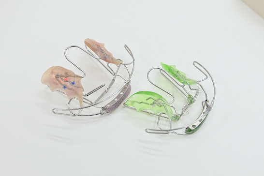 ビムラー矯正についてはこちら